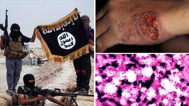 La información con comentario 08/04/2015